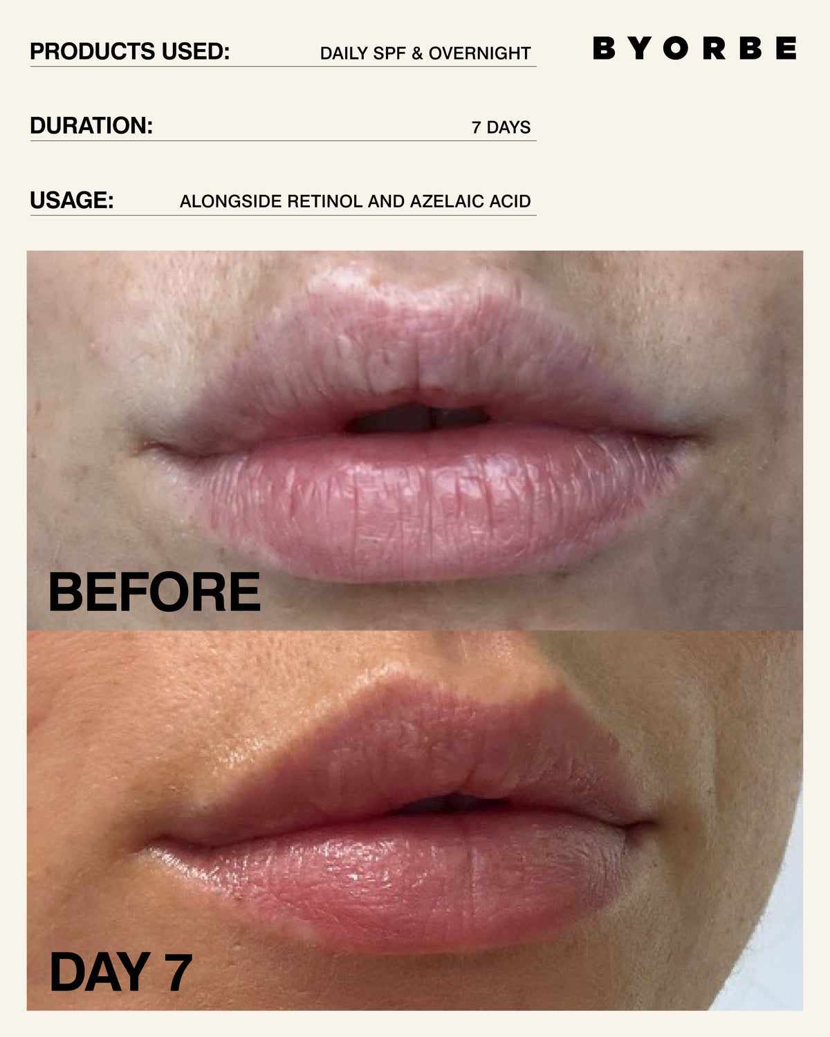 LIP BARRIER BALM DAILY SPF 50 15ML