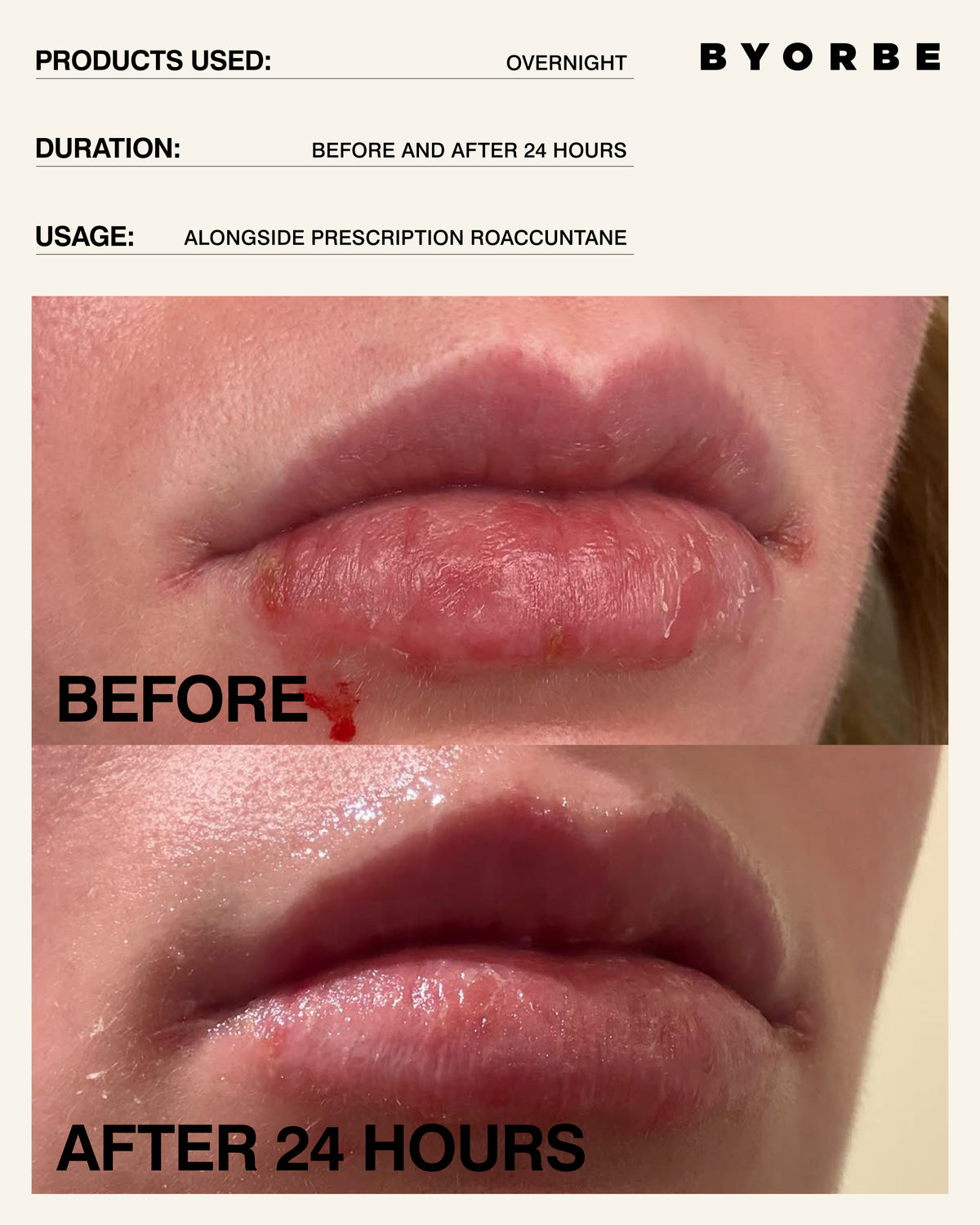 LIP BARRIER BALM OVERNIGHT 15ML